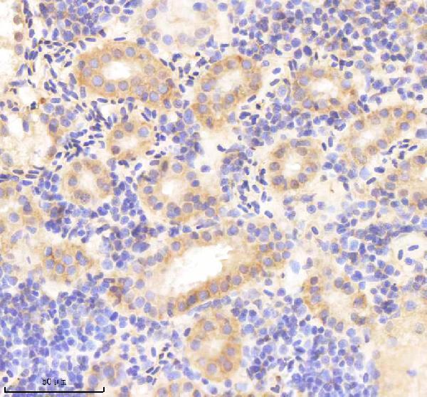 azq6nye2 rcc2 primary antibodies ihc testing 3
