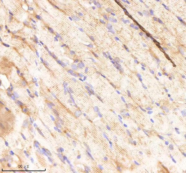azq6nye2 rcc2 primary antibodies ihc testing 4