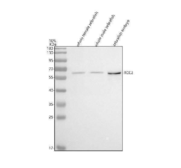 Western blot analysis of RCC2 using anti-RCC2 antibody (AZQ6NYE2)