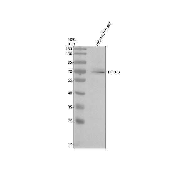 Western blot analysis of TDRD3 using anti-TDRD3 antibody (AZQ6NYG6)