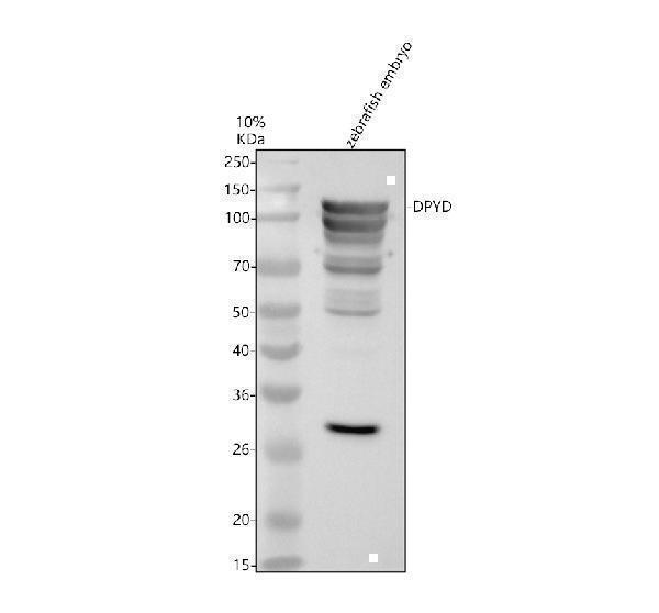 Western blot analysis of DPYD using anti-DPYD antibody (AZQ6NYG8)