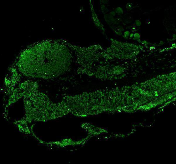 azq6nyv9 leo1 primary antibodies if testing 1
