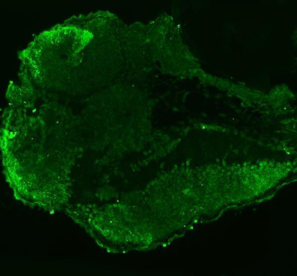 azq6nyv9 leo1 primary antibodies if testing 2_1