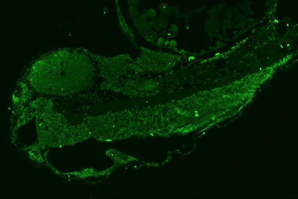 azq6nyv9 leo1 primary antibodies if testing 3_1