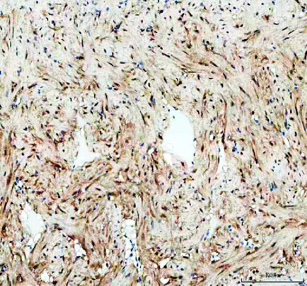 IHC analysis of LEO1 using anti-LEO1 antibody (AZQ6NYV9)