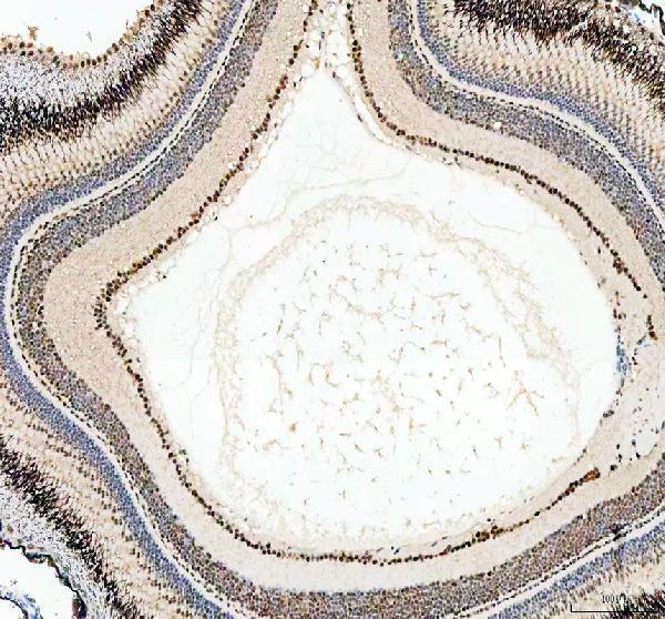 IHC analysis of LEO1 using anti-LEO1 antibody (AZQ6NYV9)