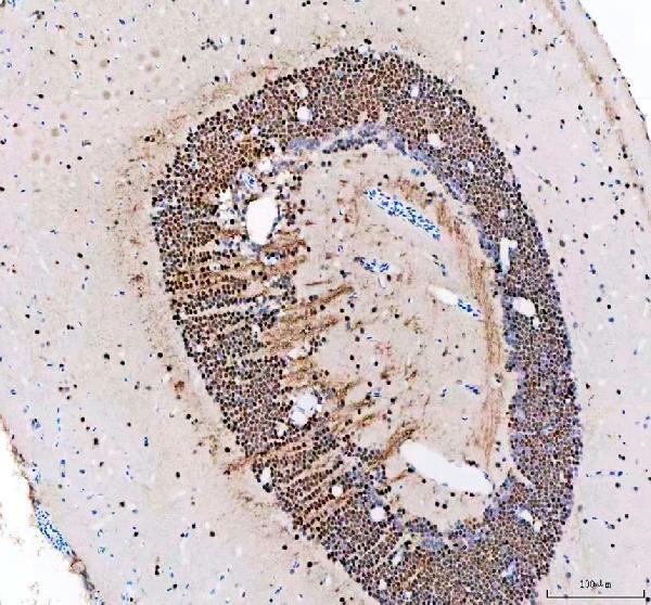 azq6nyv9 leo1 primary antibodies ihc testing 3