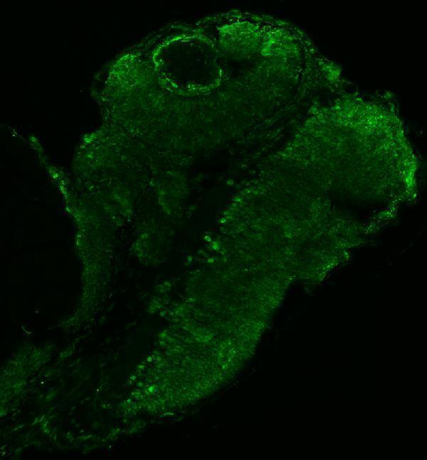 IF analysis of NF45/ILF2 using anti-NF45/ILF2 antibody (AZQ6NZ06)