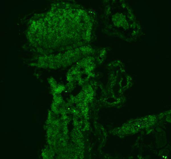 azq6nz06 ilf2 primary antibodies if testing 2