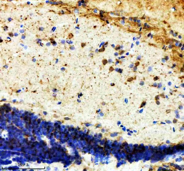  IHC analysis of NF45/ILF2 using anti-NF45/ILF2 antibody (AZQ6NZ06)