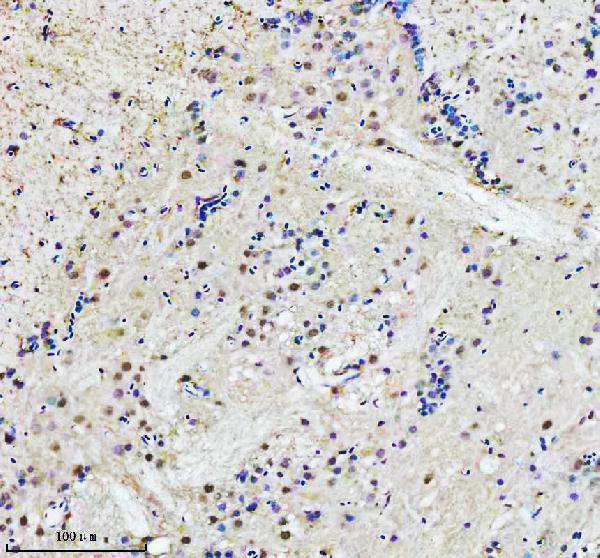 azq6nz09 adrm1 primary antibodies ihc testing 2