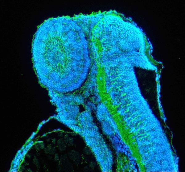IF analysis of c-Jun/JUN using anti-c-Jun/JUN antibody (AZQ6NZT5)