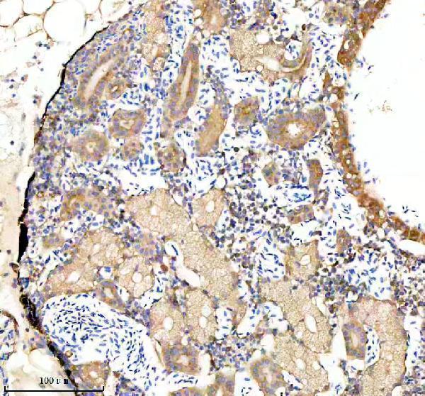 azq6nzz7 gabarapa b primary antibodies ihc testing 2