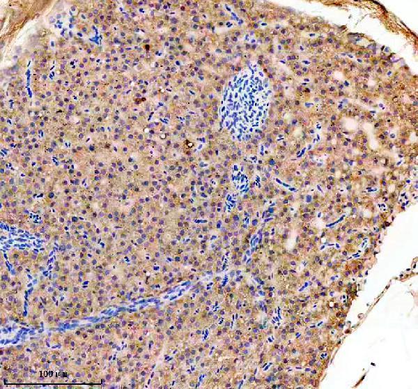 azq6nzz7 gabarapa b primary antibodies ihc testing 3