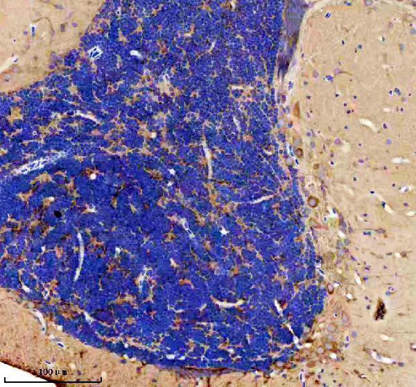 azq6nzz7 gabarapa b primary antibodies ihc testing 4
