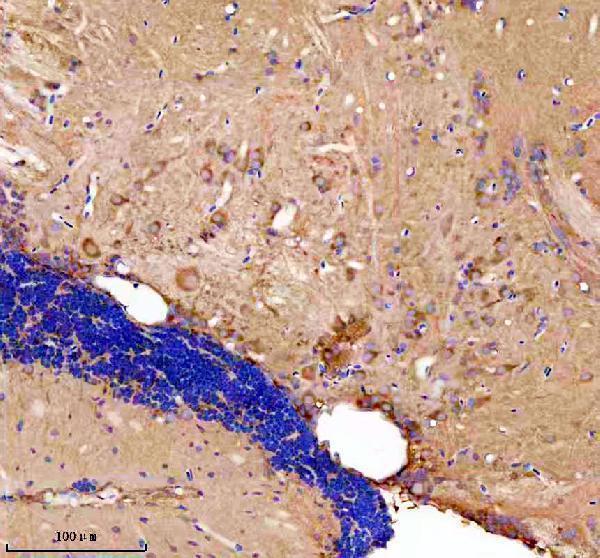 azq6nzz7 gabarapa b primary antibodies ihc testing 5
