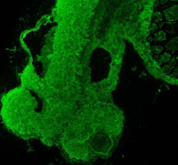 IF analysis of FOXA1 using anti-FOXA1 antibody (AZQ6P0C9)