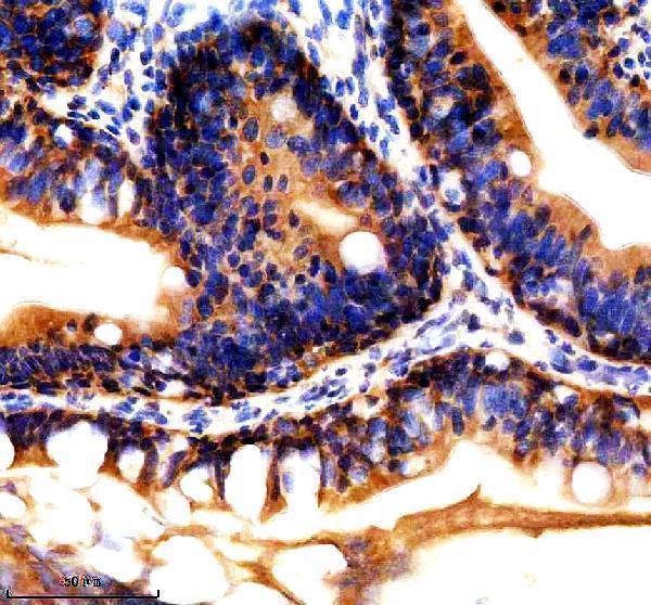 IHC analysis of RPL8 using anti-RPL8 antibody (AZQ6P0V6)