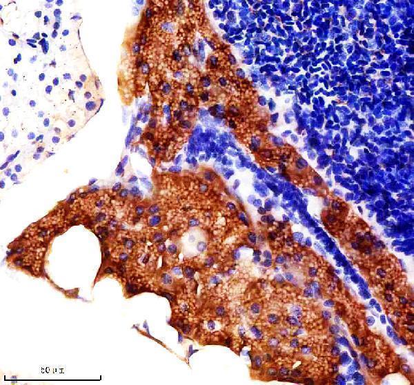 IHC analysis of RPL8 using anti-RPL8 antibody (AZQ6P0V6)