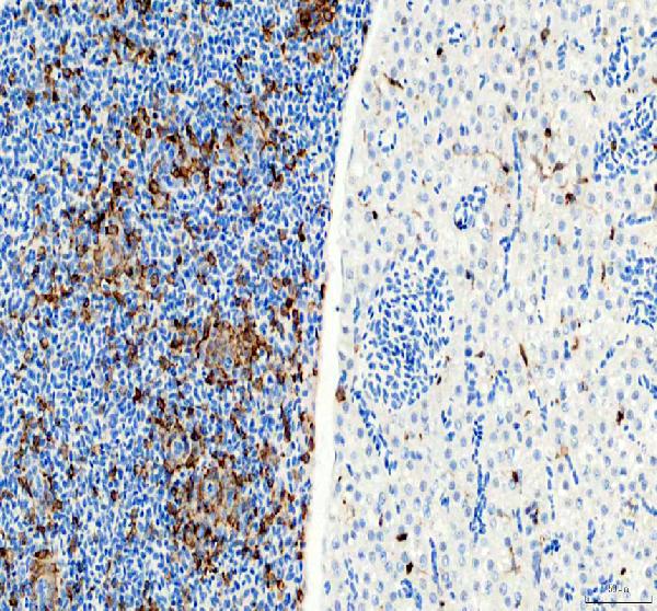 IHC analysis of LCP1entin/LCP1 using anti-LCP1entin/LCP1 antibody (AZQ6P698)