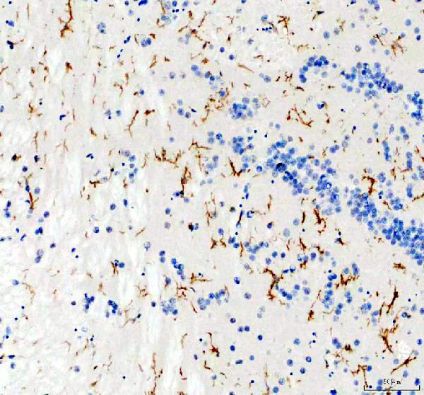 IHC analysis of LCP1entin/LCP1 using anti-LCP1entin/LCP1 antibody (AZQ6P698)