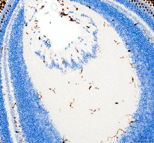 azq6p698 lcp1 primary antibodies ihc testing 3