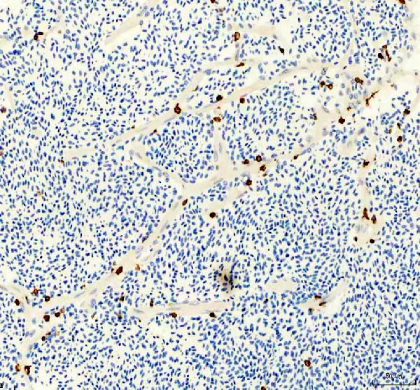 azq6p698 lcp1 primary antibodies ihc testing 4