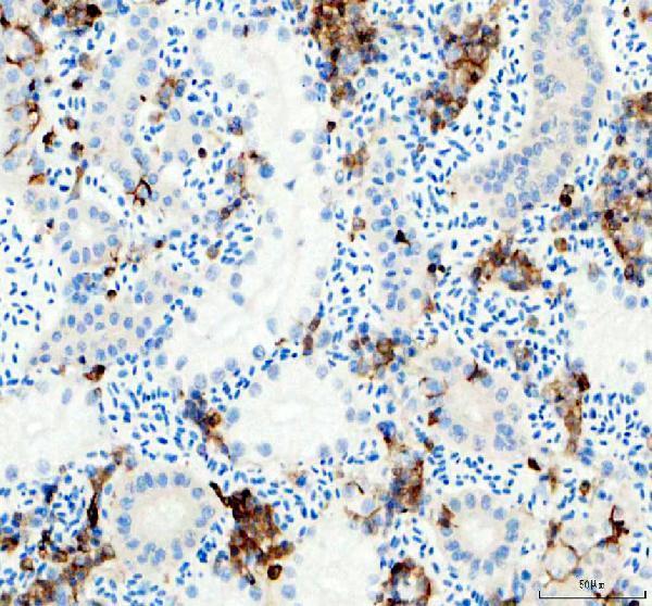 azq6p698 lcp1 primary antibodies ihc testing 5
