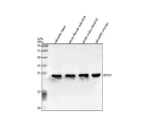  Western blot analysis of SOD2 using anti-SOD2 antibody (AZQ6P980)