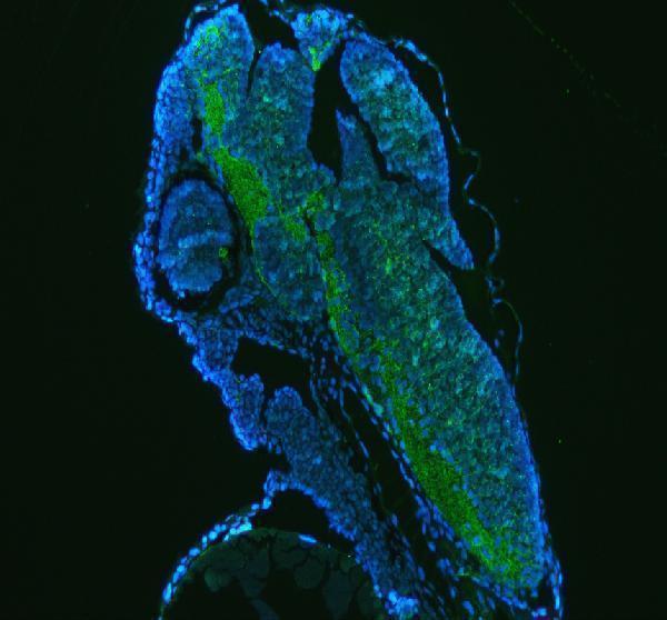 azq6pbp1 gnao1a primary antibodies if testing 6