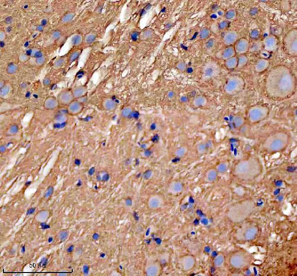 azq6pbp1 gnao1a primary antibodies ihc testing 2