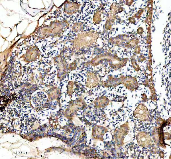 azq6pbp1 gnao1a primary antibodies ihc testing 3