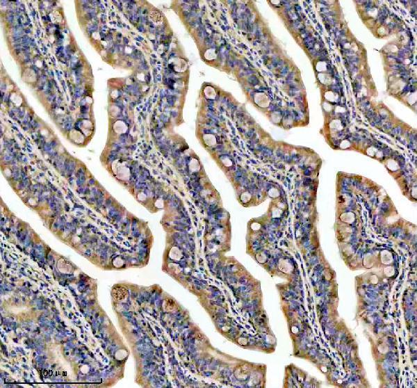 azq6pbp1 gnao1a primary antibodies ihc testing 5