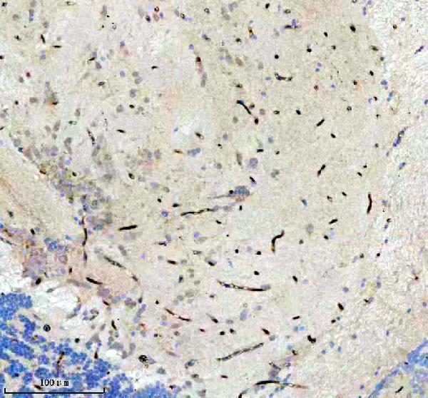  IHC analysis of JAB1/COPS5 using anti-JAB1/COPS5 antibody (AZQ6PC30)