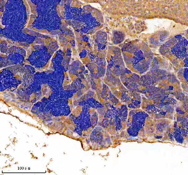  IHC analysis of JAB1/COPS5 using anti-JAB1/COPS5 antibody (AZQ6PC30)