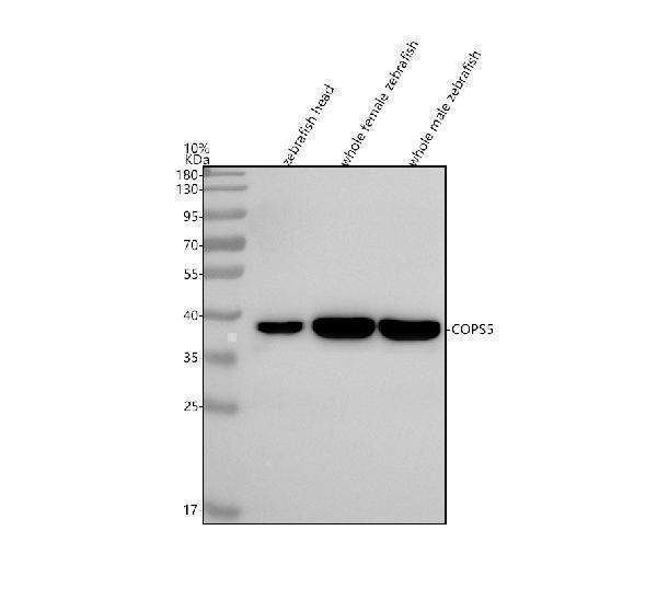  Western blot analysis of JAB1/COPS5 using anti-JAB1/COPS5 antibody (AZQ6PC30)