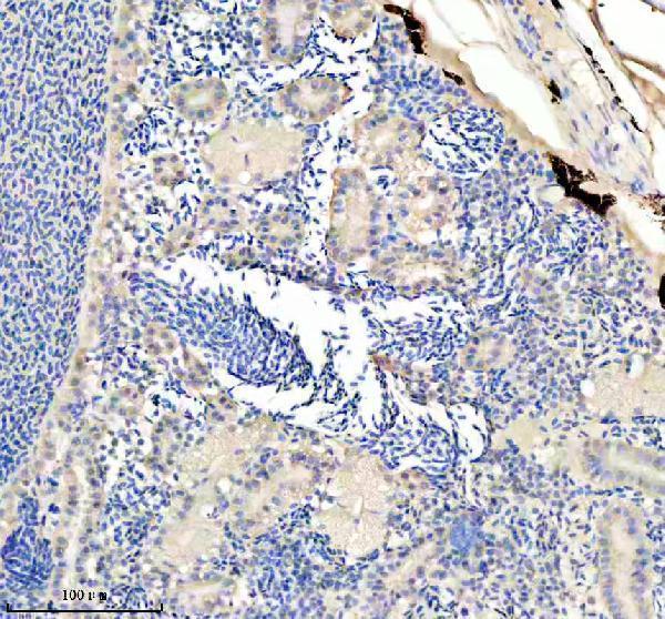 azq6pc89 eno1a b primary antibodies ihc testing 2