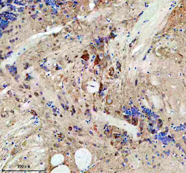  IHC analysis of EIF3A using anti-EIF3A antibody (AZQ6PCR7)