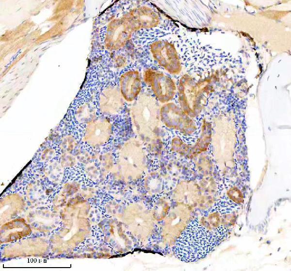  IHC analysis of EIF3A using anti-EIF3A antibody (AZQ6PCR7)