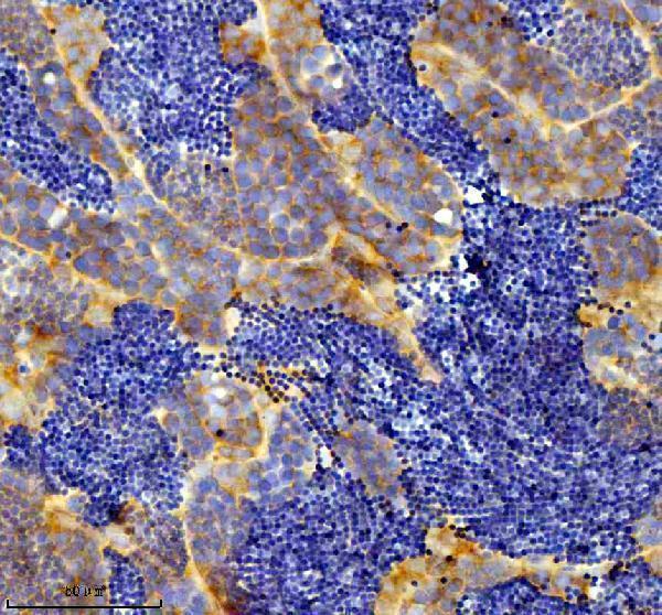 azq6pcr7 eif3a primary antibodies ihc testing 5