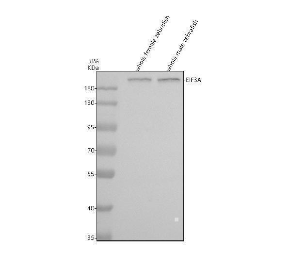  Western blot analysis of EIF3A using anti-EIF3A antibody (AZQ6PCR7)