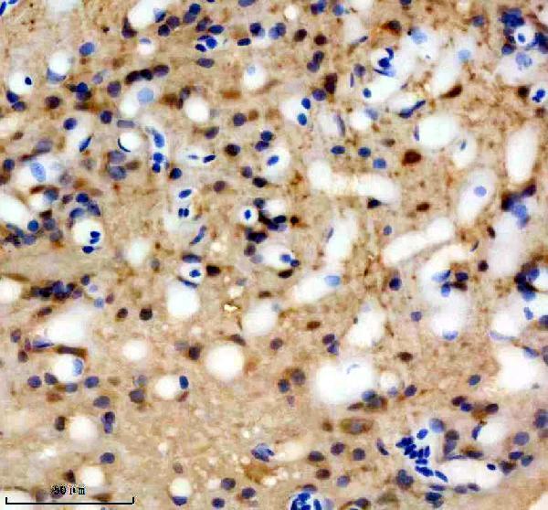 IHC analysis of IRF6 using anti-IRF6 antibody (AZQ6PGZ7)