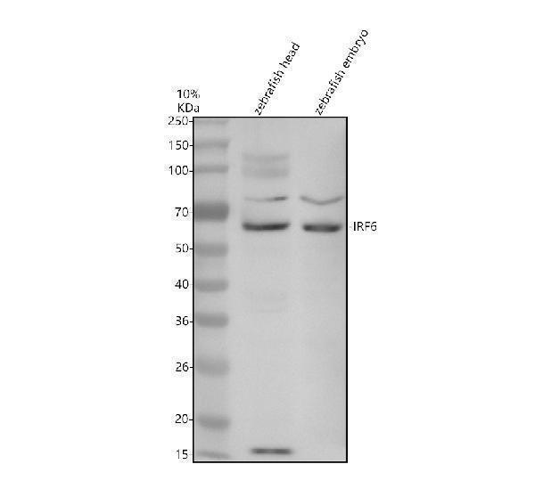 Western blot analysis of IRF6 using anti-IRF6 antibody (AZQ6PGZ7)