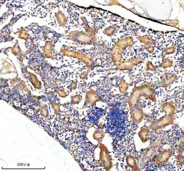  IHC analysis of CRKL using anti-CRKL antibody (AZQ6PH06)
