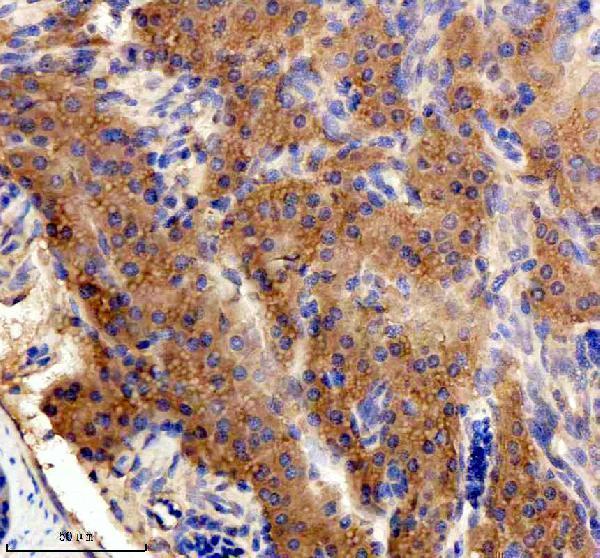  IHC analysis of CRKL using anti-CRKL antibody (AZQ6PH06)