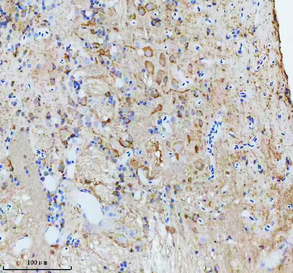  IHC analysis of CCT4 using anti-CCT4 antibody (AZQ6PH46)