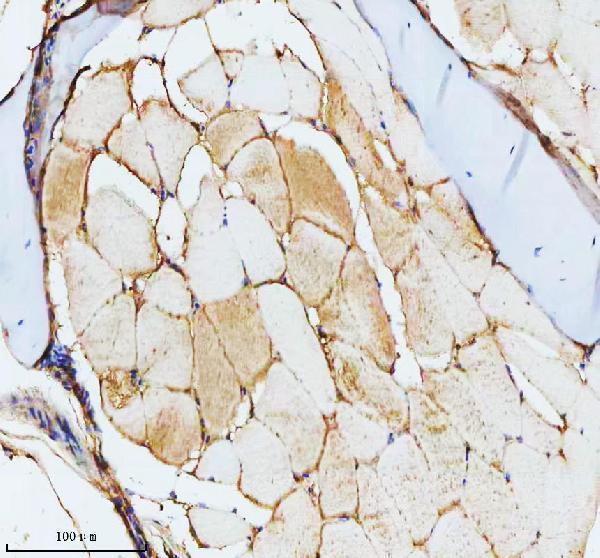  IHC analysis of CCT4 using anti-CCT4 antibody (AZQ6PH46)