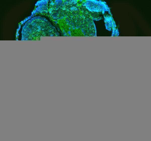 azq6ph57 gnb1 1b primary antibodies if testing 3