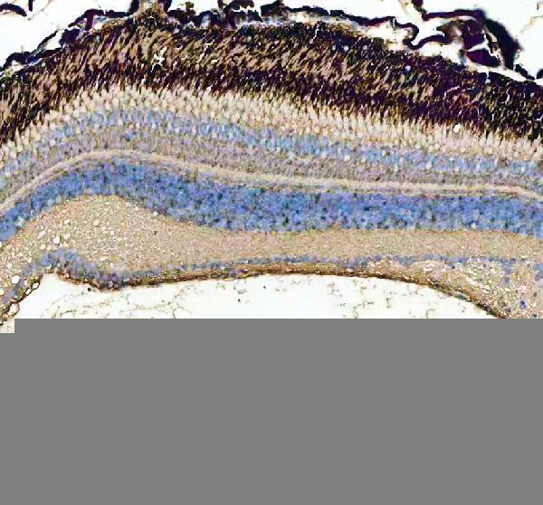 azq6ph57 gnb1 1b primary antibodies ihc testing 2