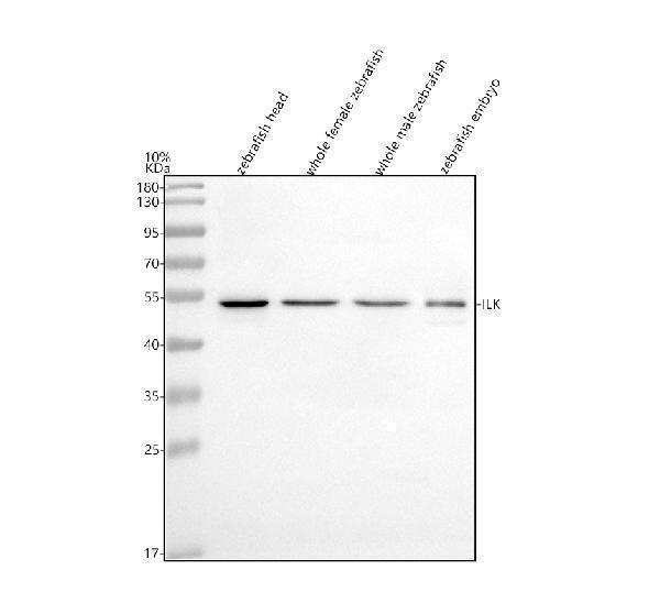  Western blot analysis of ILK using anti-ILK antibody (AZQ6PHD6-1)
